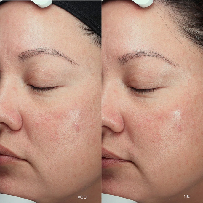 Dermalogica - Magnetic[+] Afterglow Cleanser